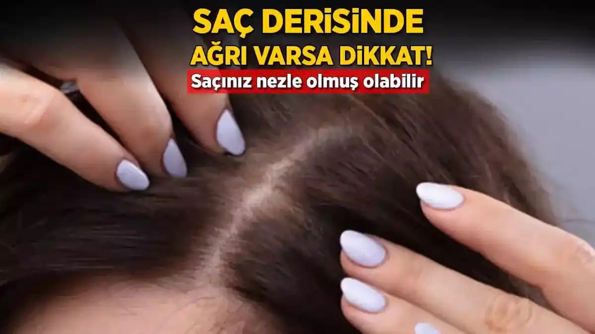 Saç Diplerindeki Ağrı Nedenleri ve Etkili Bakım Yöntemleri Hakkında Kapsamlı Rehber