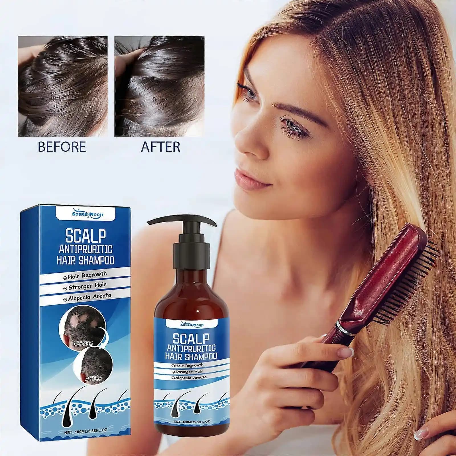 Saçtaki Mantar Enfeksiyonları İçin Etkili Anti-Fungal Şampuanlar ve Bakım Önerileri