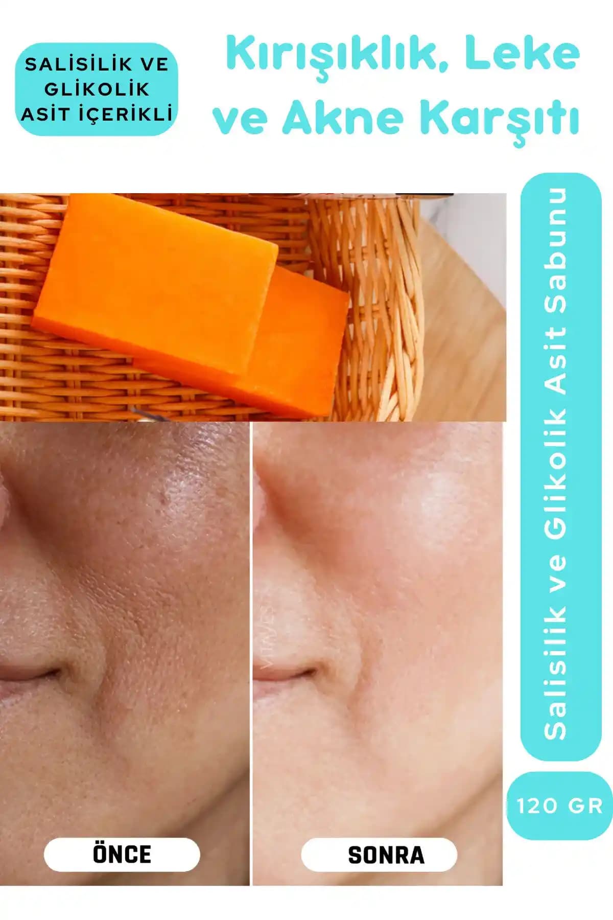 Salisilik Asit ve Glikolik Asit: Cilt Bakımında Birlikte Kullanımın Faydaları ve Dikkat Edilmesi Gerekenler