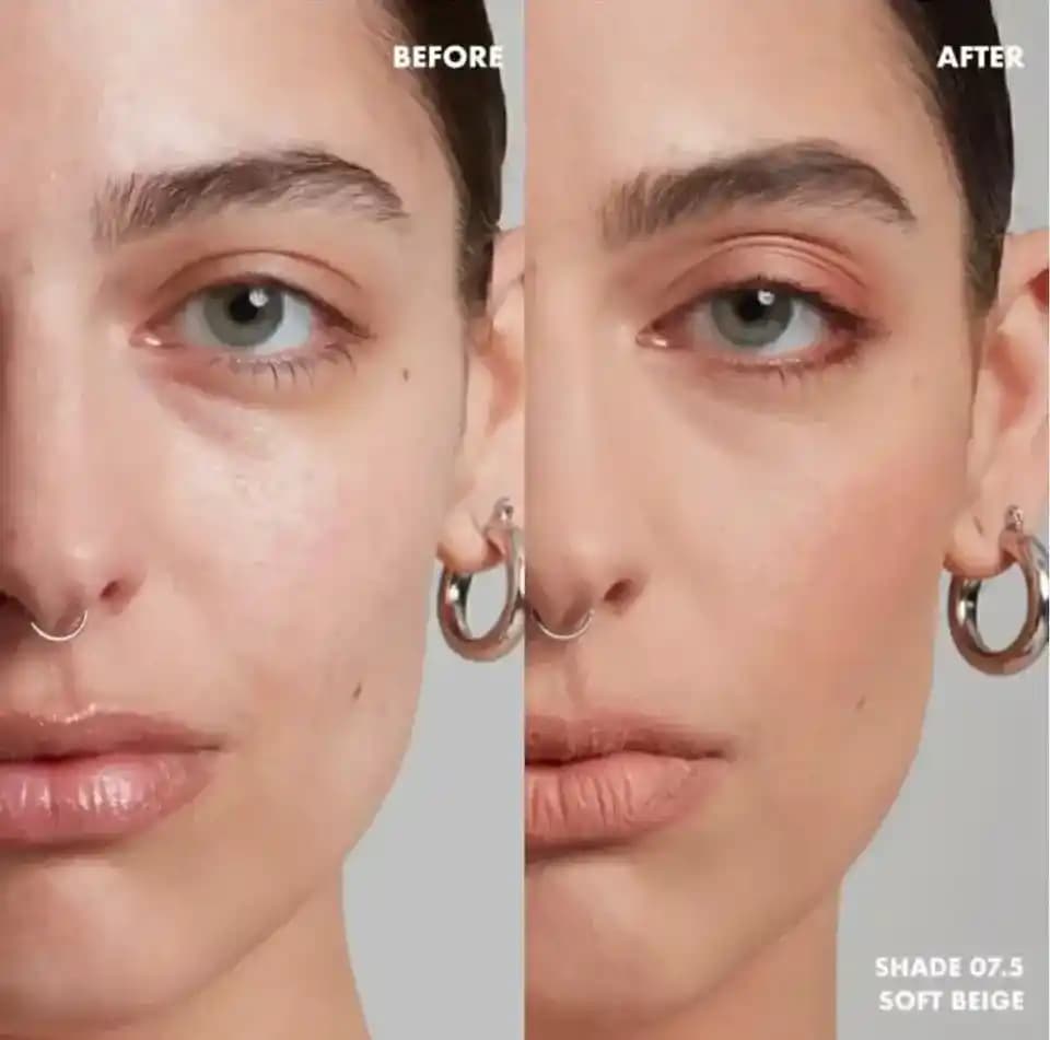 Sivilceli Ciltlere Uygun Fondoten Seçimi ve Doğru Uygulama Teknikleri Rehberi