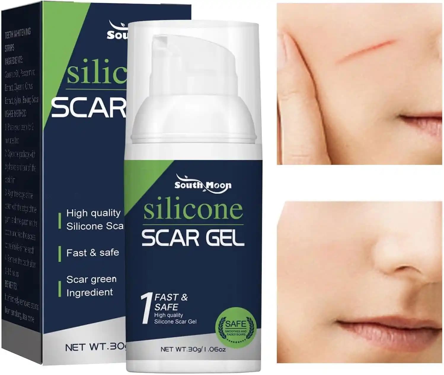 Skar İzlerini Azaltmada Etkili Krem Seçimi ve Doğru Cilt Bakımı Yöntemleri