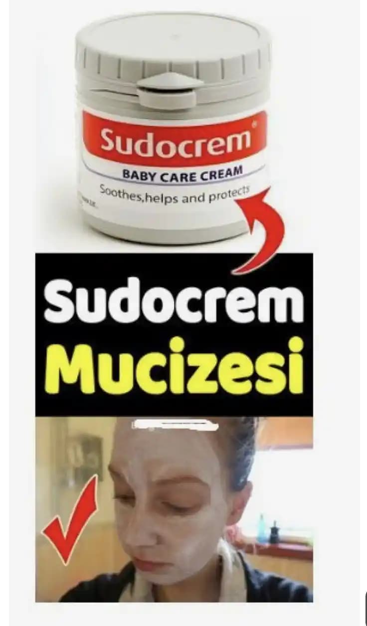 Sudocrem ve Sivilce İzleri: Etkileri ve Cilt Bakımında Doğru Kullanım Yöntemleri