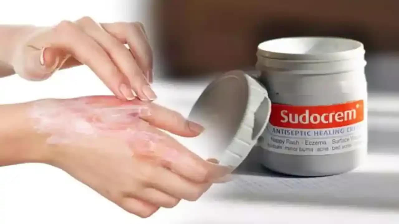 Sudocrem ve Vajinal Mantar Enfeksiyonları: Etkisi ve Uygun Tedavi Yöntemleri
