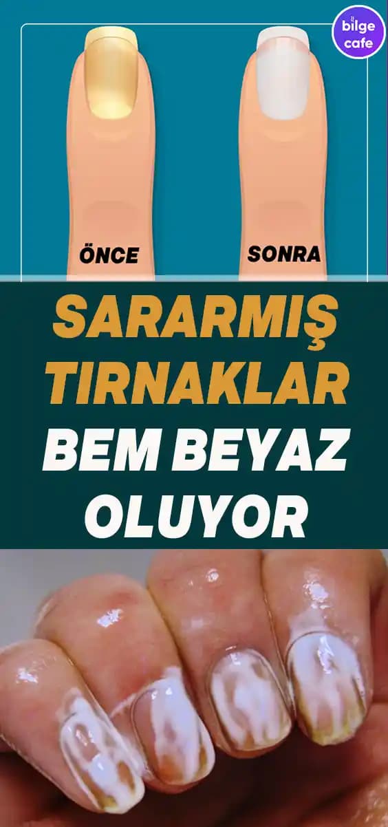 Tırnak Etlerine İyi Gelen Doğal Yöntemler ve Etkili Bakım Önerileri