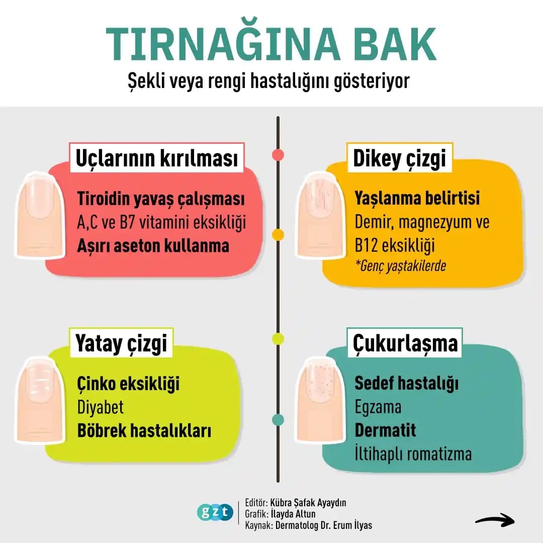 Tırnakların Görevleri ve Sağlık ile Güzellik Açısından Önemi ve Bakım Önerileri