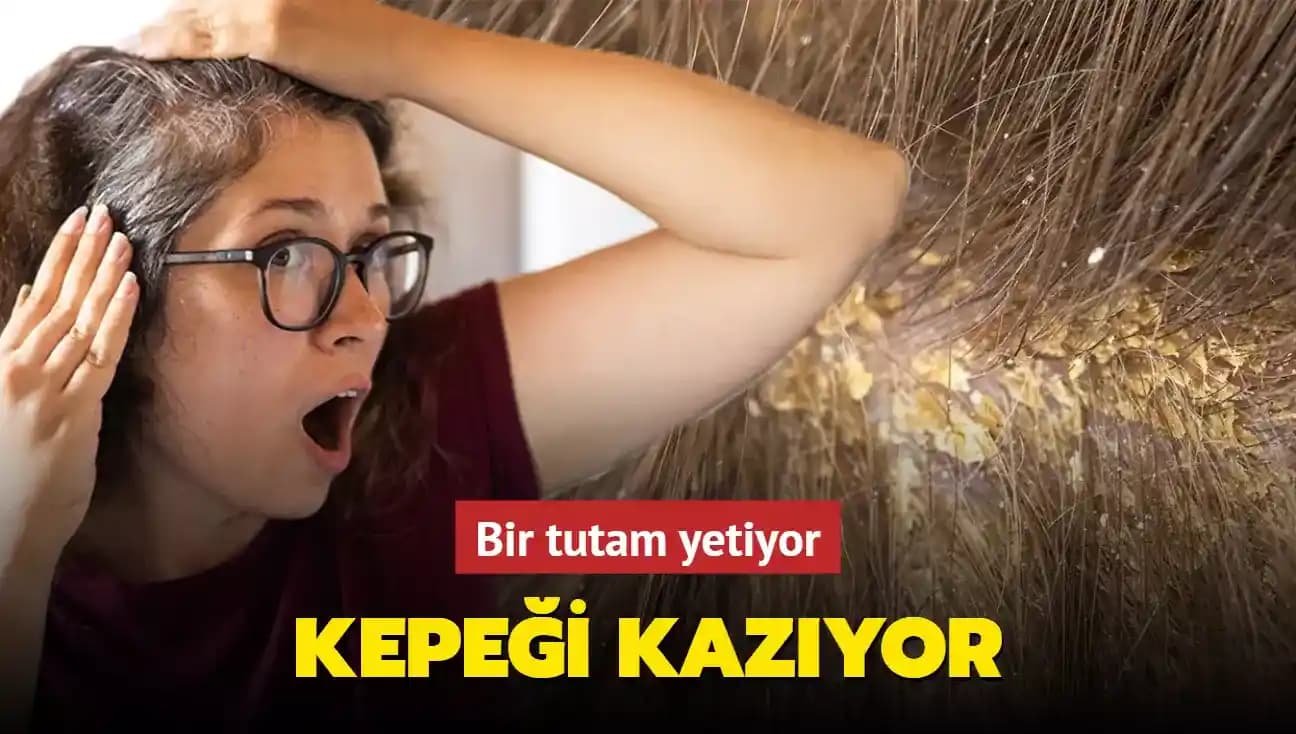 Tuz Kepeği Nedir? Saç ve Cilt Sağlığını Korumanın Temel Yolları