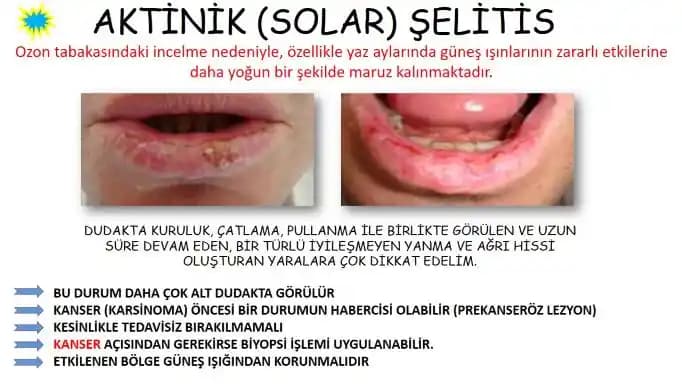 Vücudun Kuruması: Nedenleri, Belirtileri ve Etkili Nemlendirme Çözümleri