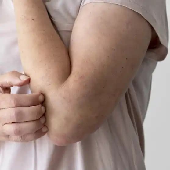 Vücutta Kabarcık ve Kaşıntı Nedenleri, Tedavisi ve Bakım Önerileri
