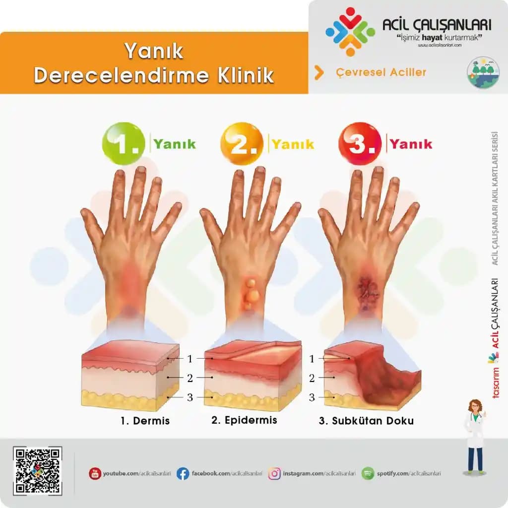 Yanık Yüz Bakımı: Güneş ve Kimyasal Yanıklara Karşı Etkili Koruma ve Tedavi Yöntemleri