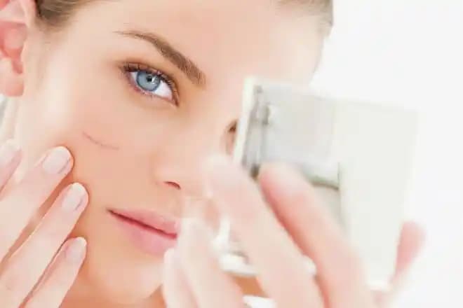 Yüzde Tırnak İzine İyi Gelen Doğal ve Medikal Tedavi Yöntemleri Hakkında Bilgi