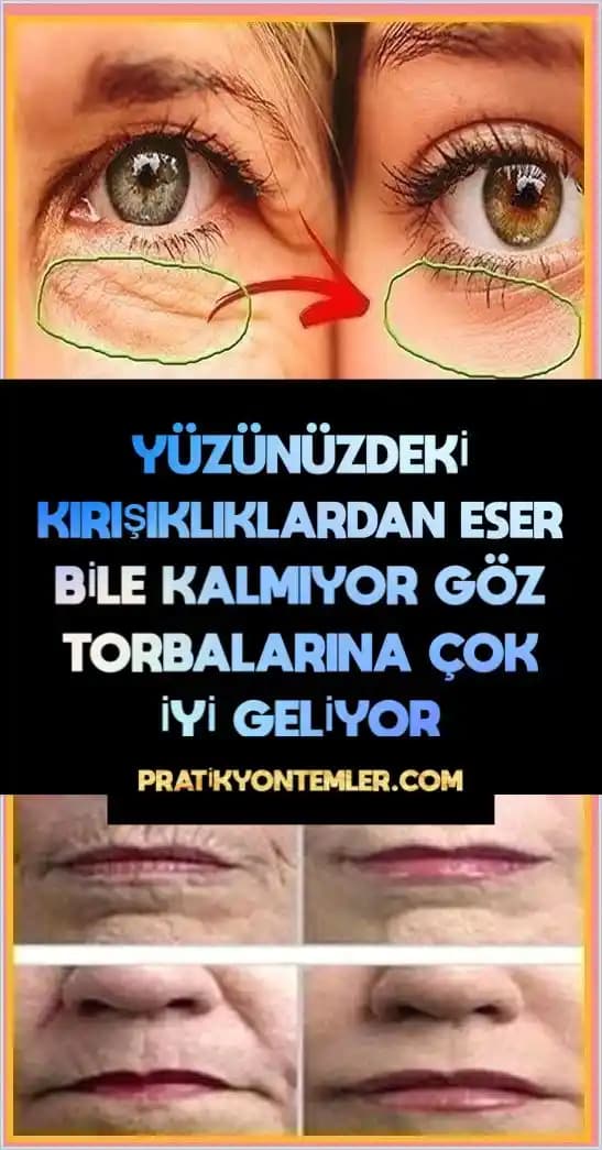 Yüzdeki Kırışıklıklar Nasıl Giderilir: Etkili Doğal ve Medikal Çözümler Rehberi