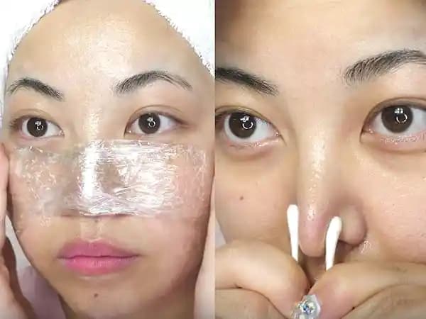 Yüze Vazelin Sürmenin Faydaları ve Riskleri: Cilt Tipine Göre Doğru Kullanım