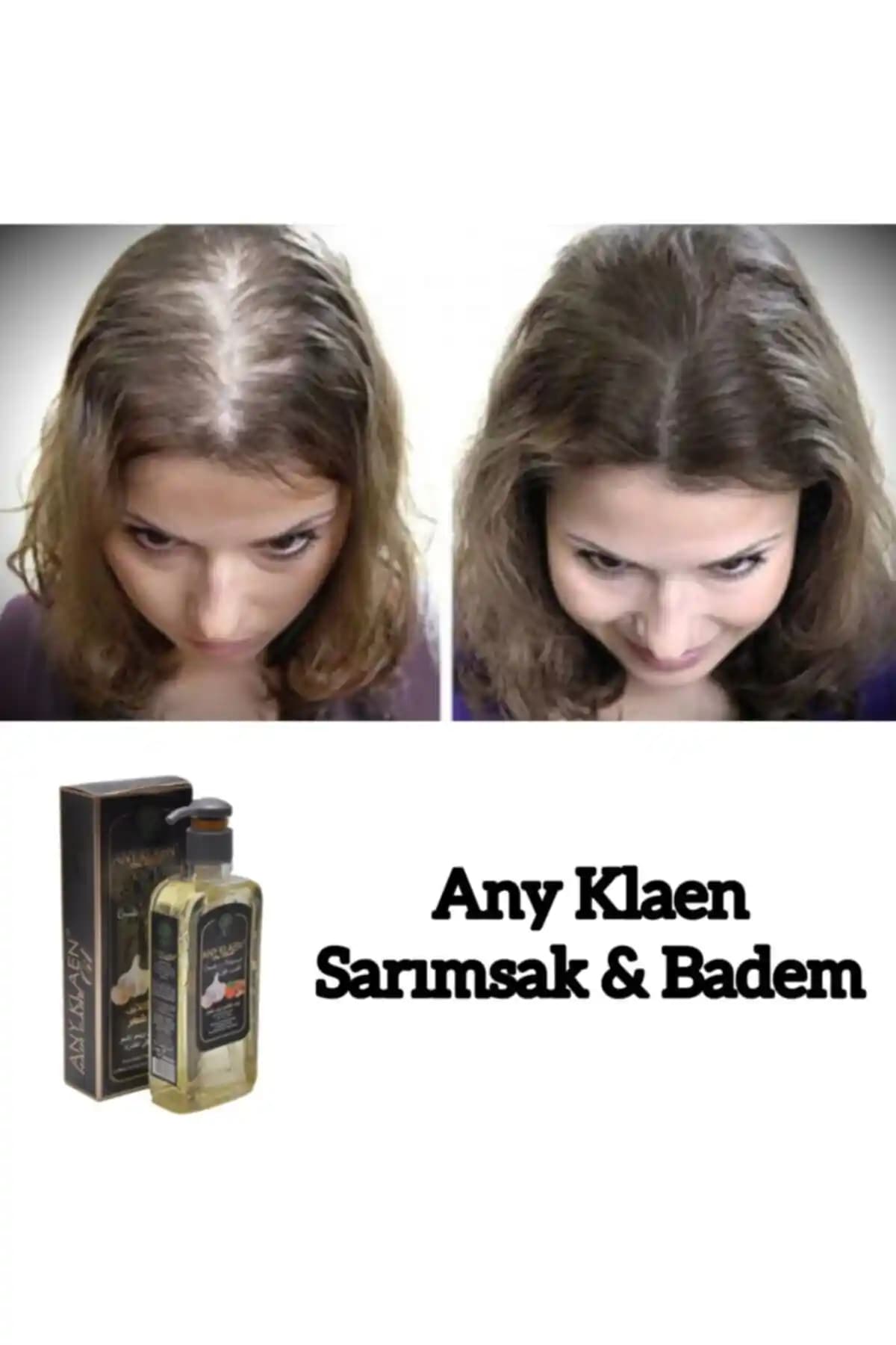 Any Klaen Hair Oil - Badem ve Sarımsak Özlü Saç Bakım Yağı ile Doğal Saç Sağlığı