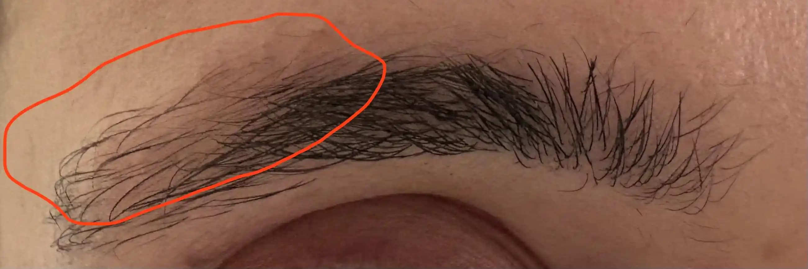 Erkeklerde Yara İzi Nedeniyle Seyrek Kaşların Doğal ve Cilt Dostu Yöntemlerle Doldurulması