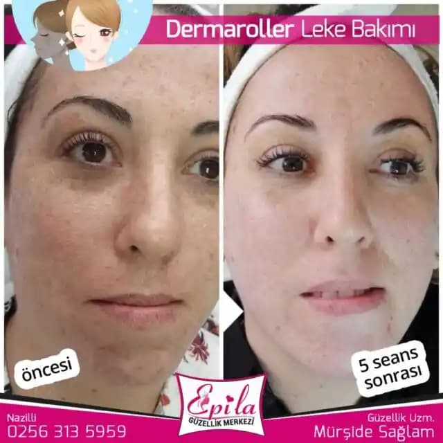 Estetisyenlerde Ürün Satış Baskısı ve Kişiselleştirilmiş Cilt Bakımı Arasındaki Çatışmanın Analizi