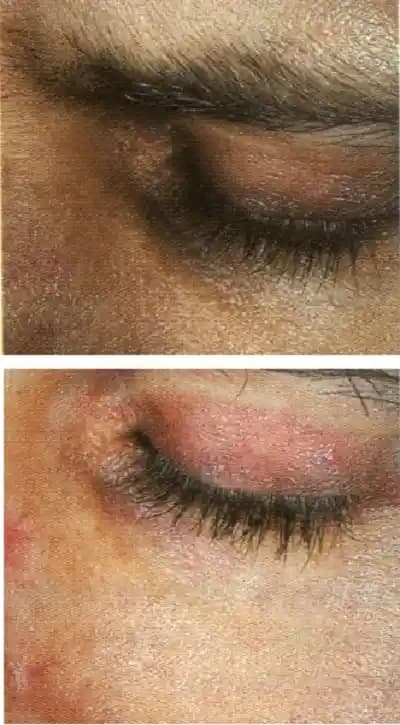 Göz Altı Morlukları ve Torbalarının Gizlenmesi İçin Etkili Makyaj Teknikleri ve Ürün Seçimi