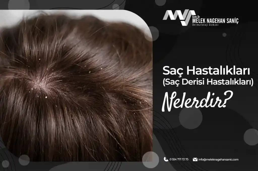 Saç Kurutma Sonrası Saçta Ekşi Koku Oluşumunun Nedenleri ve Etkili Çözümleri