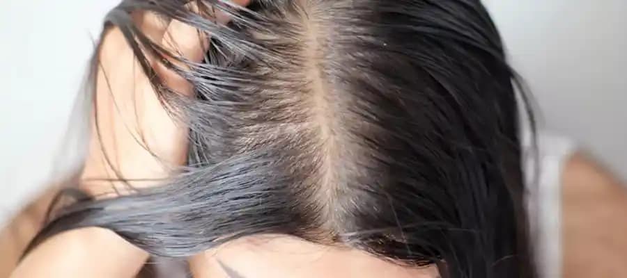 Saç Yağlanmasının Bilimsel Temelleri ve Yıkama Alışkanlıklarının Saç Sağlığına Etkisi