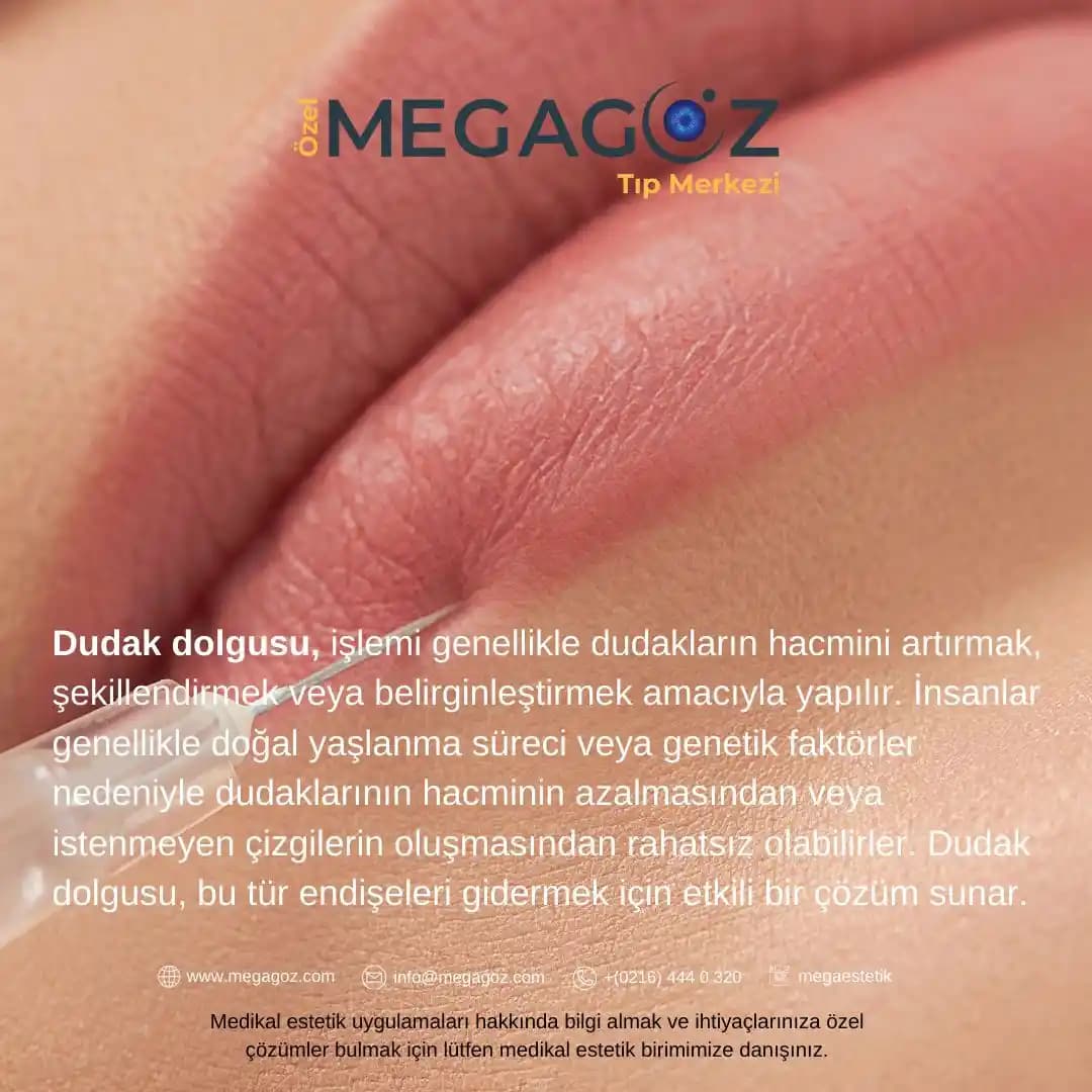 Üst Dudak Kıllanması: Nedenleri, Tedavi Yöntemleri ve Yönetim Stratejileri