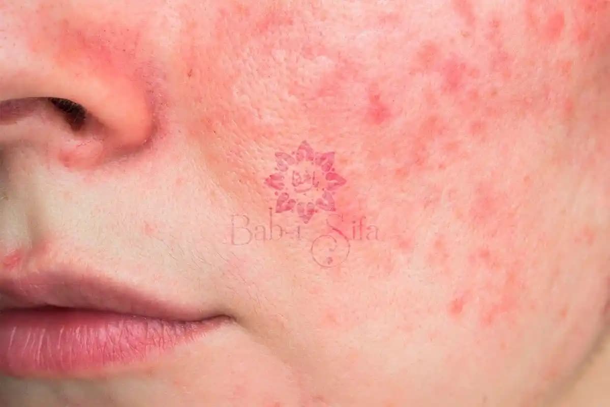 Uygun Fiyatlı Fondöten Seçiminde Kapatıcılık, Kalıcılık ve Cilt Tipine Uygun Öneriler