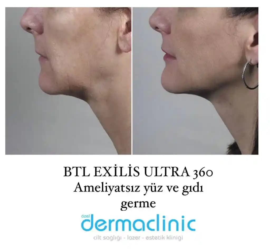 Yüz ve Vücut Losyonlarının Cilt Bakımında Kullanımı ve Dikkat Edilmesi Gerekenler