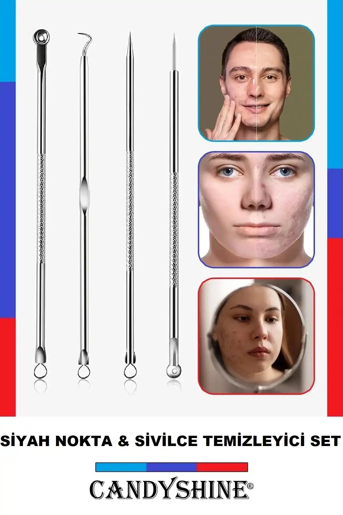 CandyShine Akne ve Siyah Nokta Temizleyici Seti ile Etkili Cilt Bakımı Çözümü