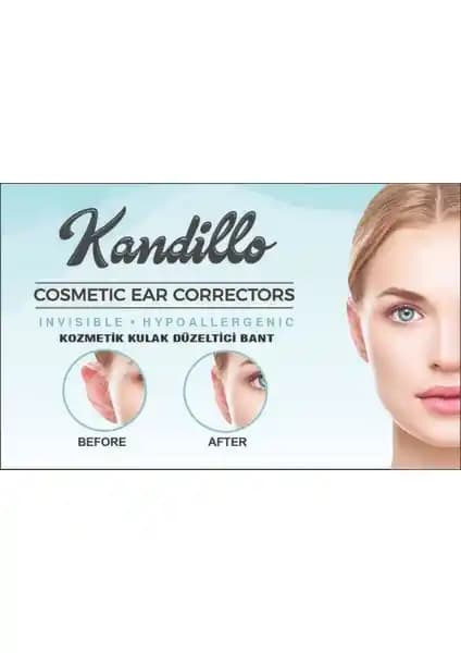 Kandillo Kepçe Kulak Bandı Günlük Kullanım İçin Estetik ve Güvenli Çözüm