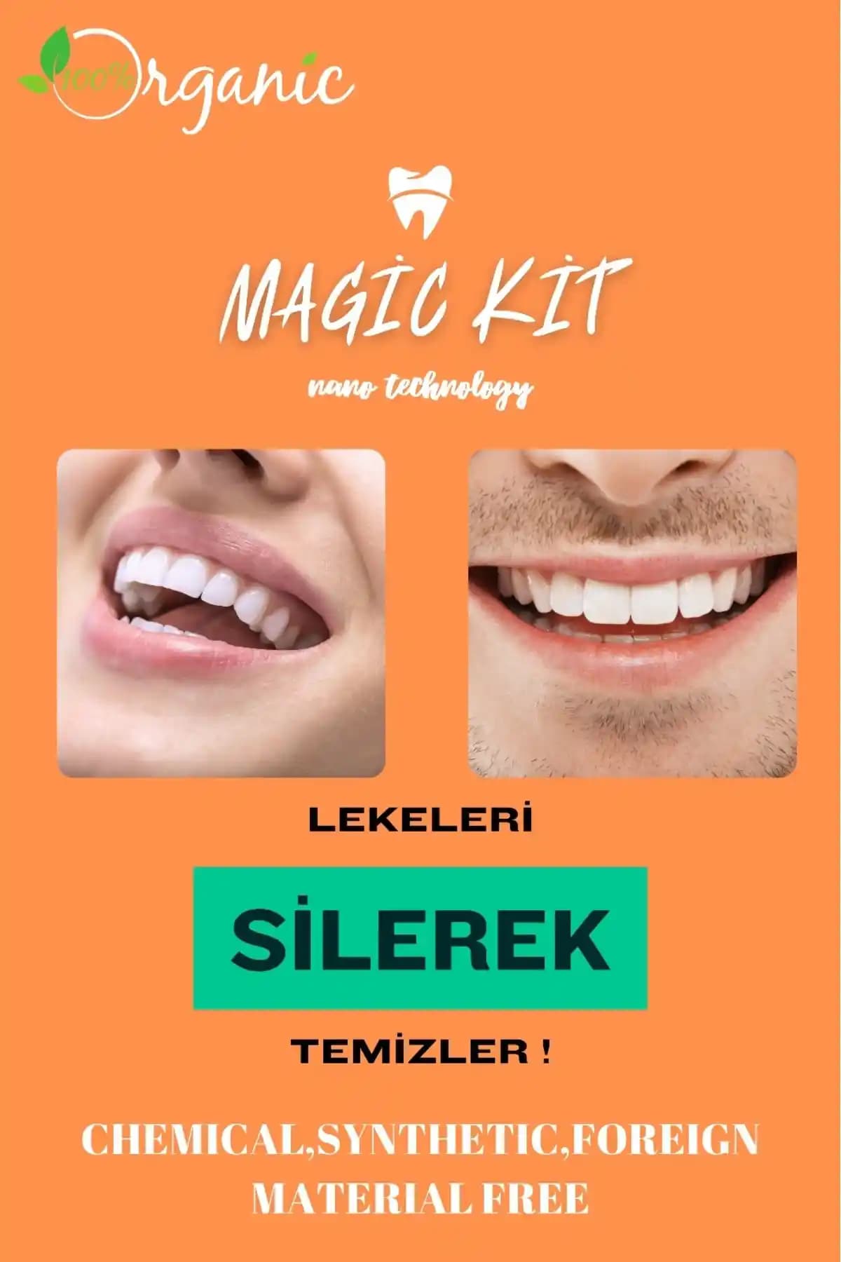 Magic Kit Diş Leke Silgisi: Nanoteknolojik Diş Beyazlatma Çözümü ve Kullanım İpuçları