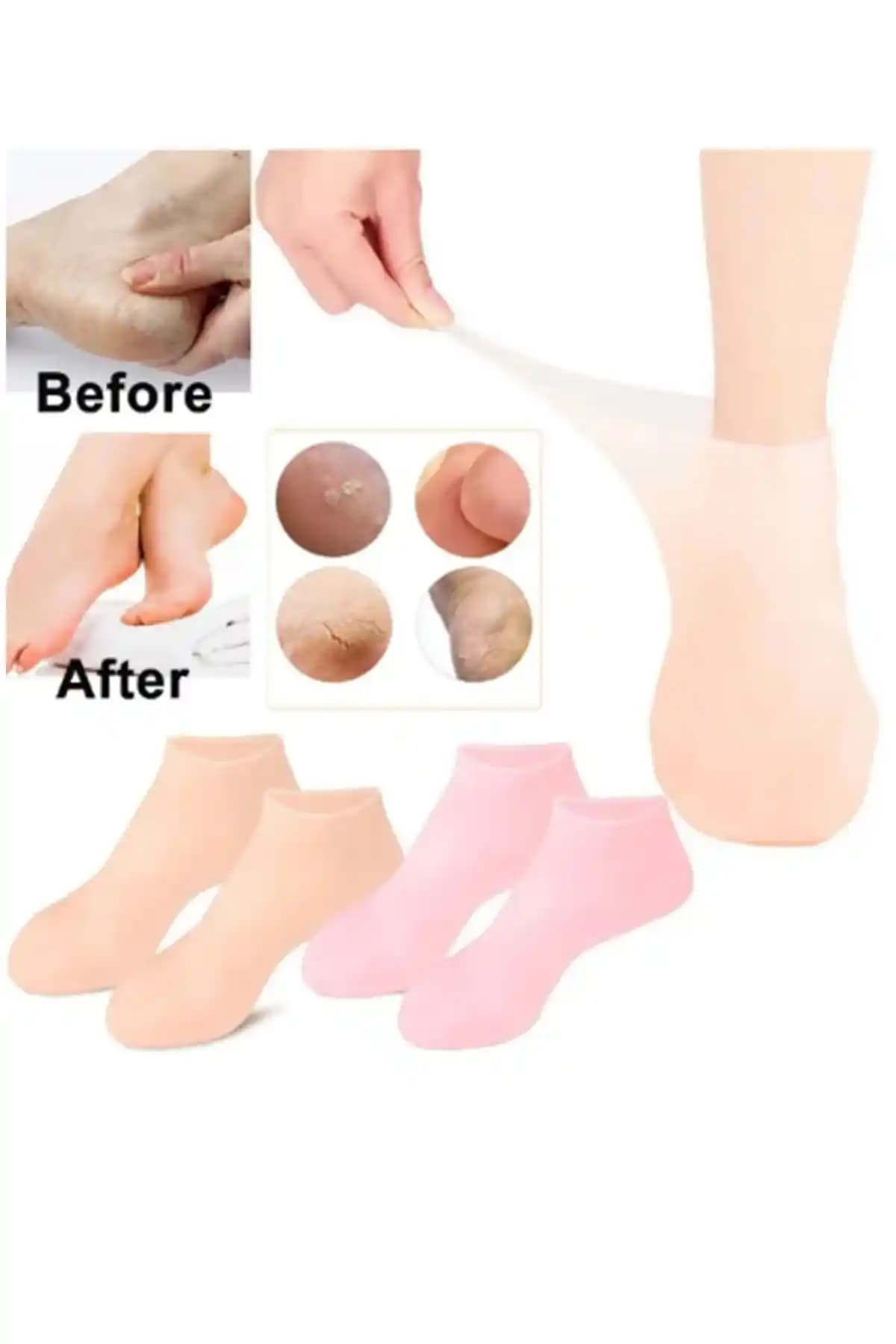 Silikon Nemlendirici Ayak Maskesi Spa Jeli Topuk Çoraplarıyla Ayak Bakımında Yenilik