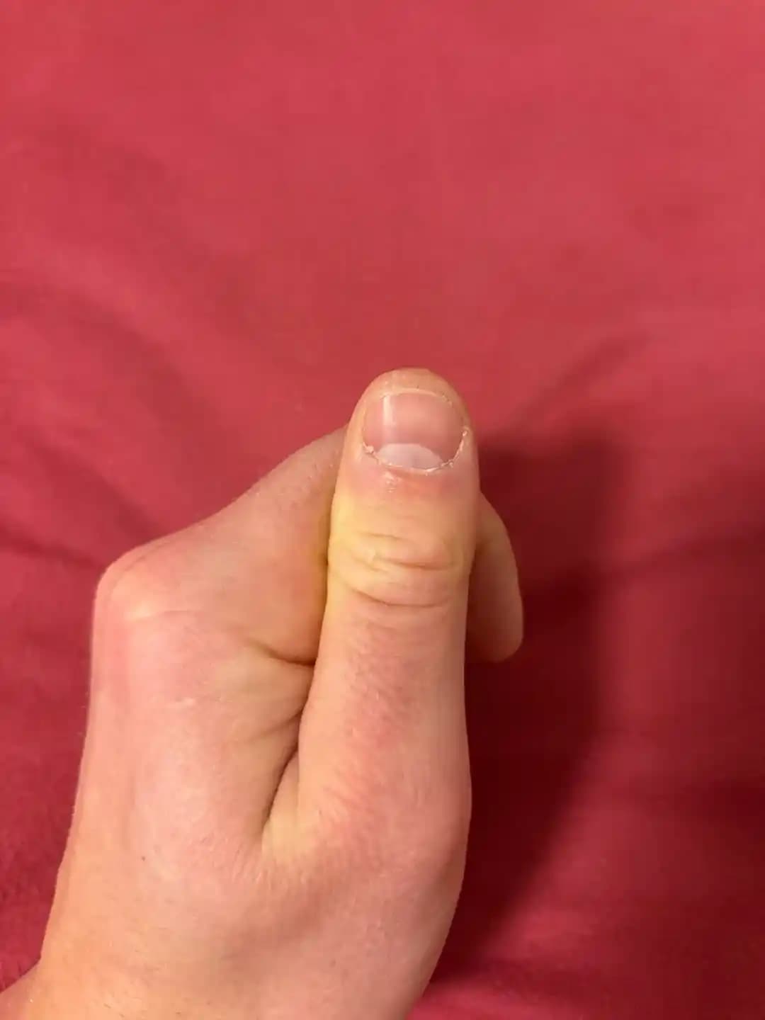 Eller ve Parmaklar İçin Etkili Bakım Yöntemleri ve Koruma Önerileri