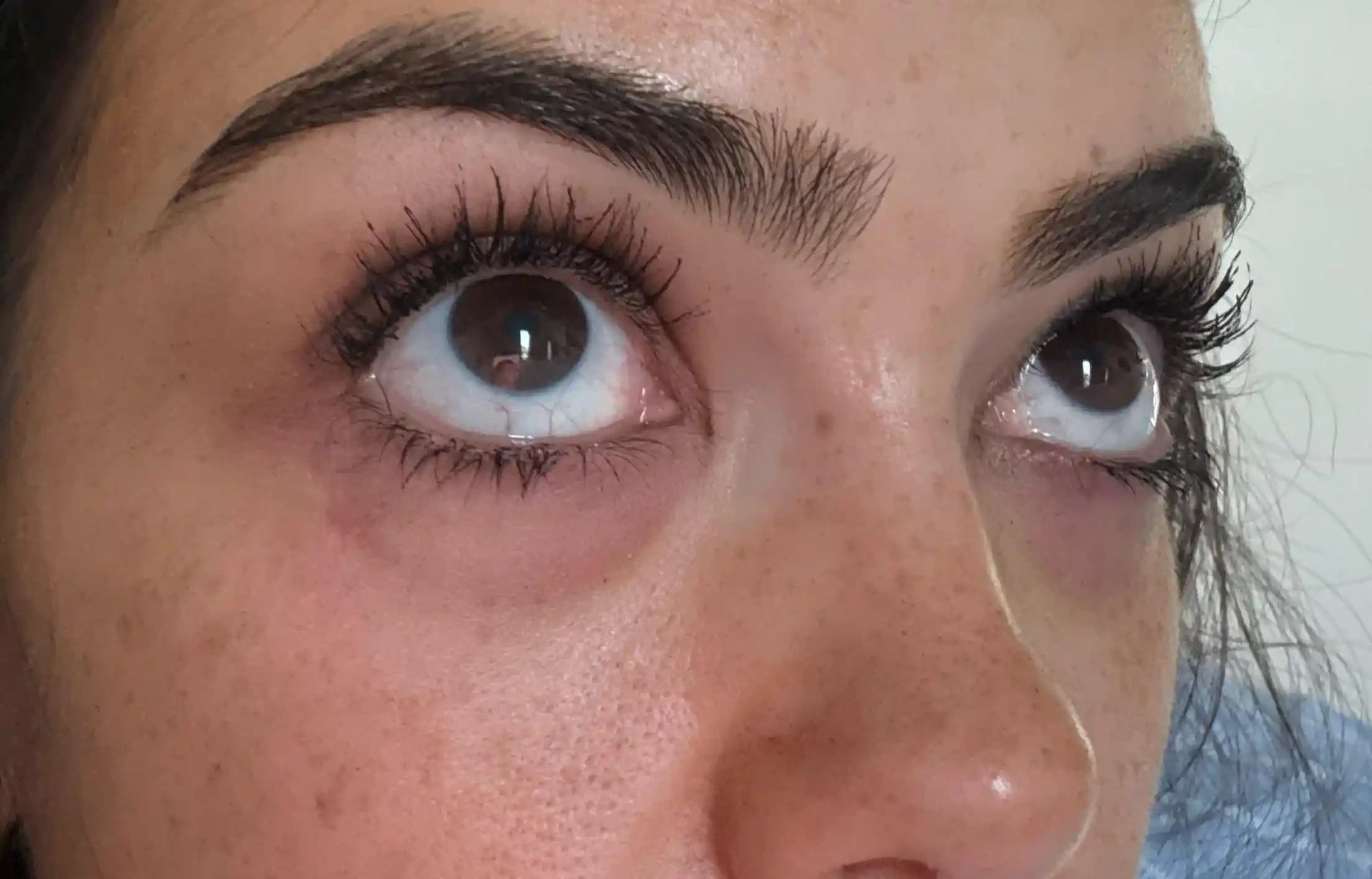 Göz Altı Cilt Bakımı: İnce Çizgiler, Koyu Halkalar ve Kolajen Kaybı İçin Etkili Çözümler