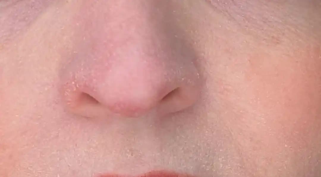 Kuru Ciltler İçin Doğru Nemlendirme Yöntemleri ve Hindistan Cevizi Yağının Etkileri